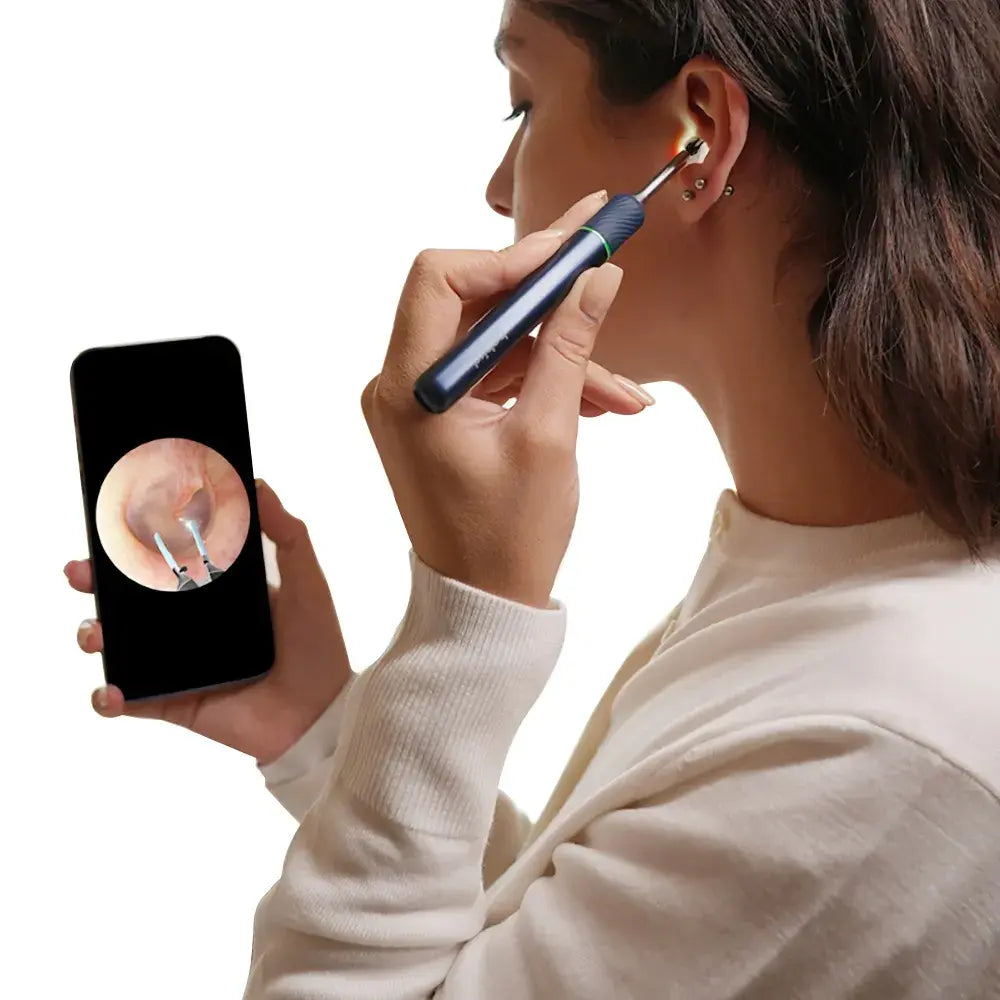 Bebird Note5 Pro Ear Wax Removal with Light 230mAh Battery 1080P Camera 360° Gyro Stabilizer Wireless