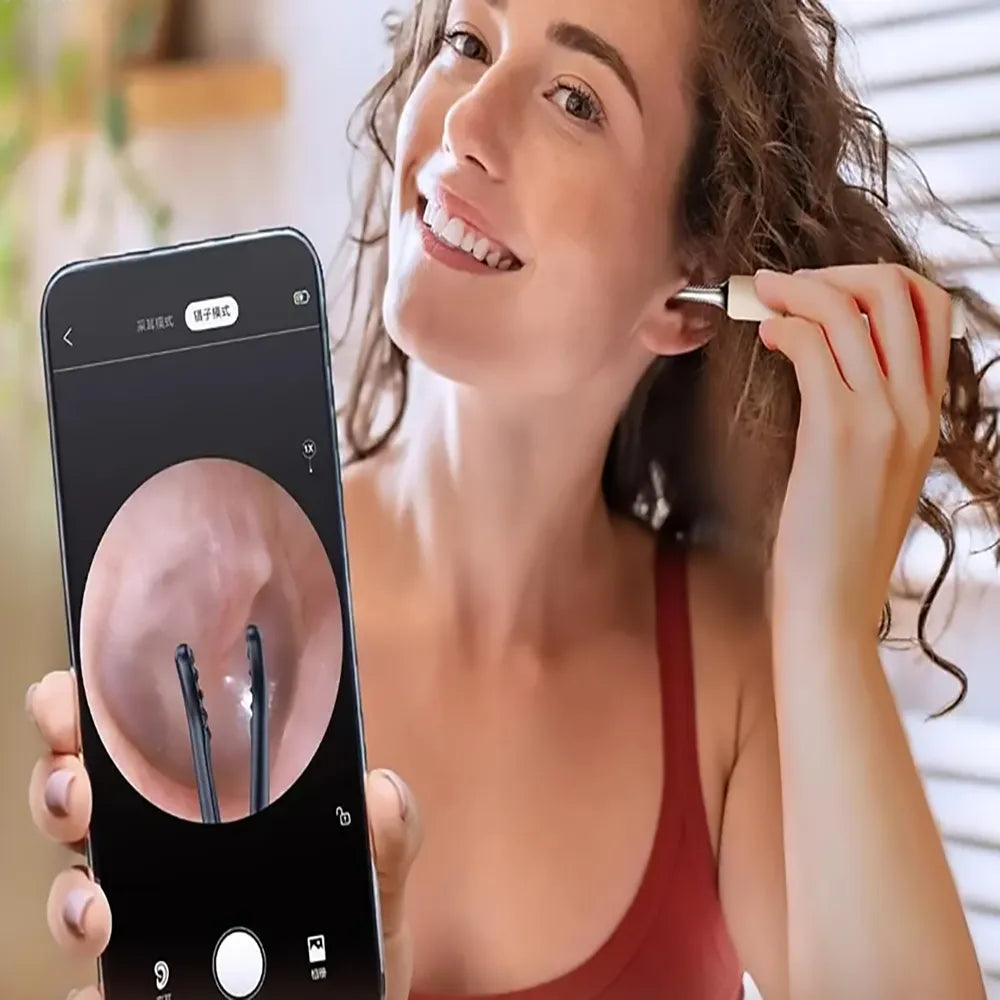 4-in-1 Visual Ear Pick Tweezers with 10 MP Camera 350mAh Battery Type-C Rechargeable