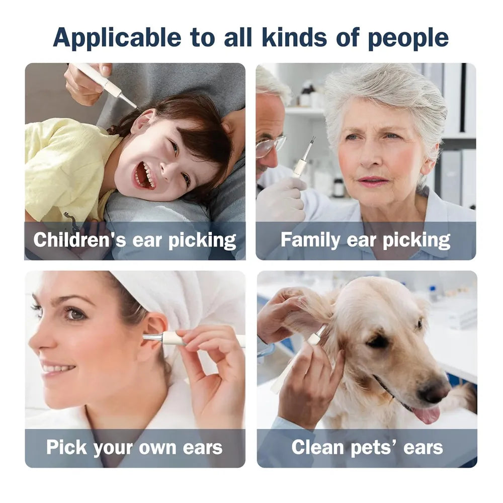4-in-1 Visual Ear Pick Tweezers with 10 MP Camera 350mAh Battery Type-C Rechargeable