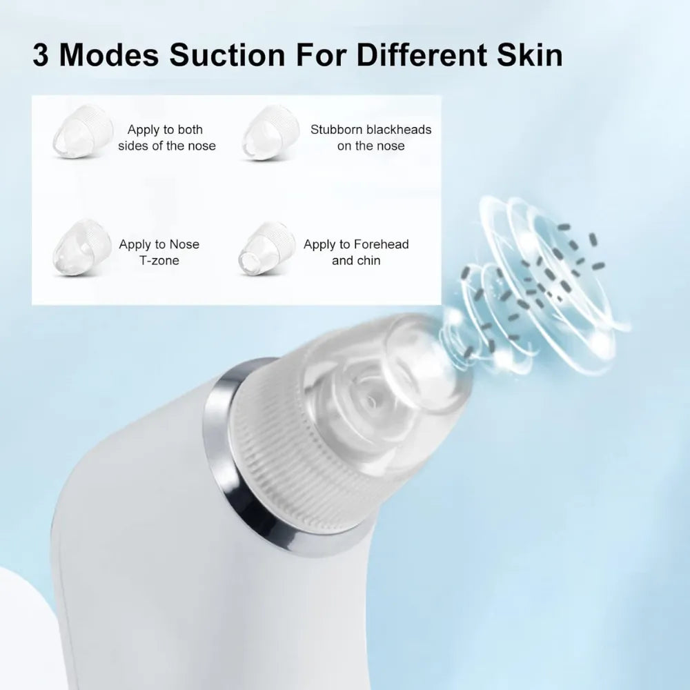 K.SKIN KD802P Electric Blackhead Remover with Small Bubble Pore Cleaning & Magic Shovel Technology