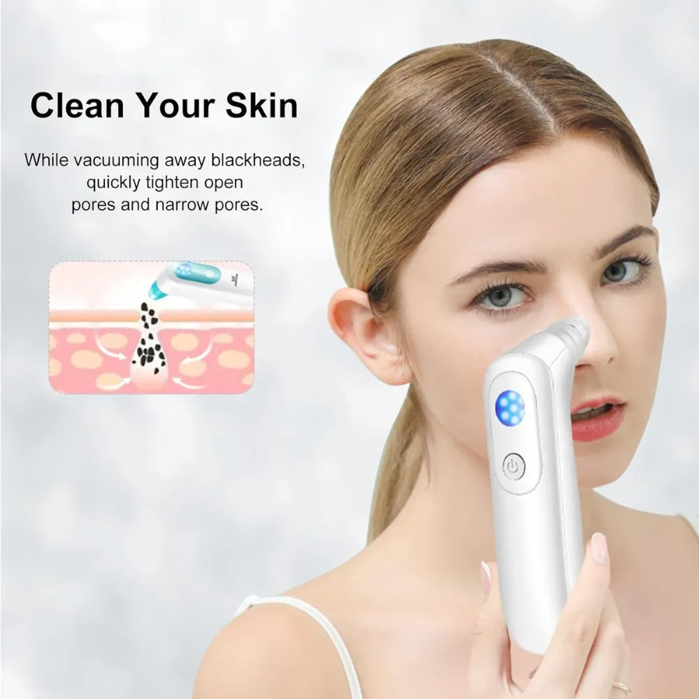 K.SKIN KD802P Electric Blackhead Remover with Small Bubble Pore Cleaning & Magic Shovel Technology