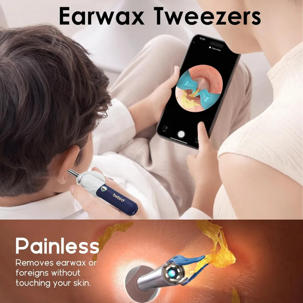 Bebird Earsight Plus Wireless Ear Wax Removal Camera - For Adults And Kids
