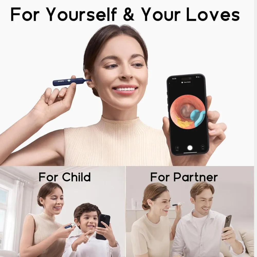 Bebird Earsight Plus Wireless Ear Wax Removal Camera - For Adults And Kids