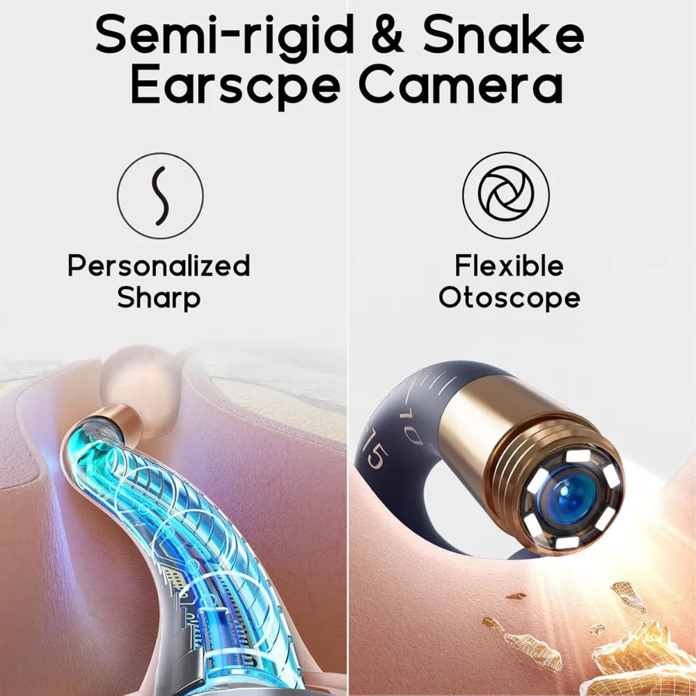 Bebird Earsight Plus Wireless Ear Wax Removal Camera - For Adults And Kids