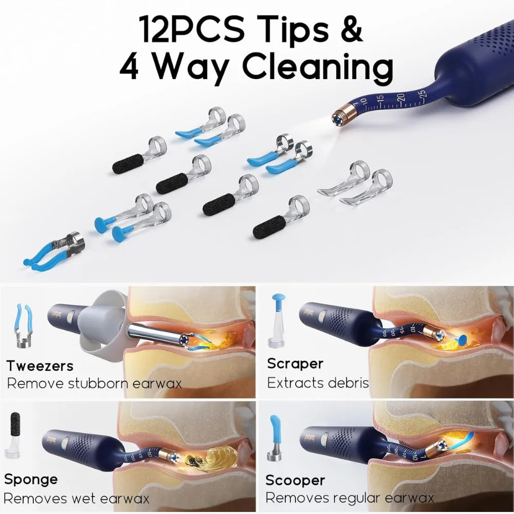 Bebird Earsight Plus Wireless Ear Wax Removal Camera - For Adults And Kids