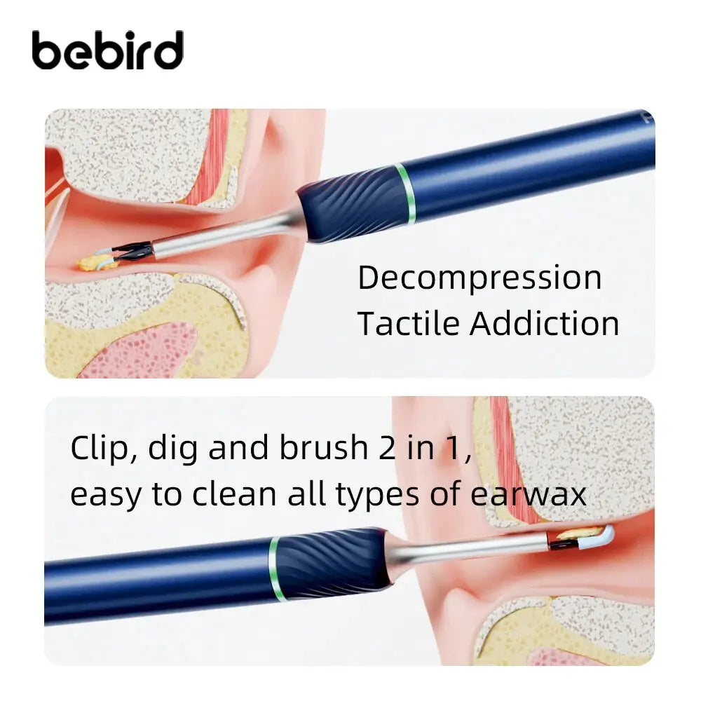 Bebird Note5 Pro Ear Wax Removal with Light 230mAh Battery 1080P Camera 360° Gyro Stabilizer Wireless