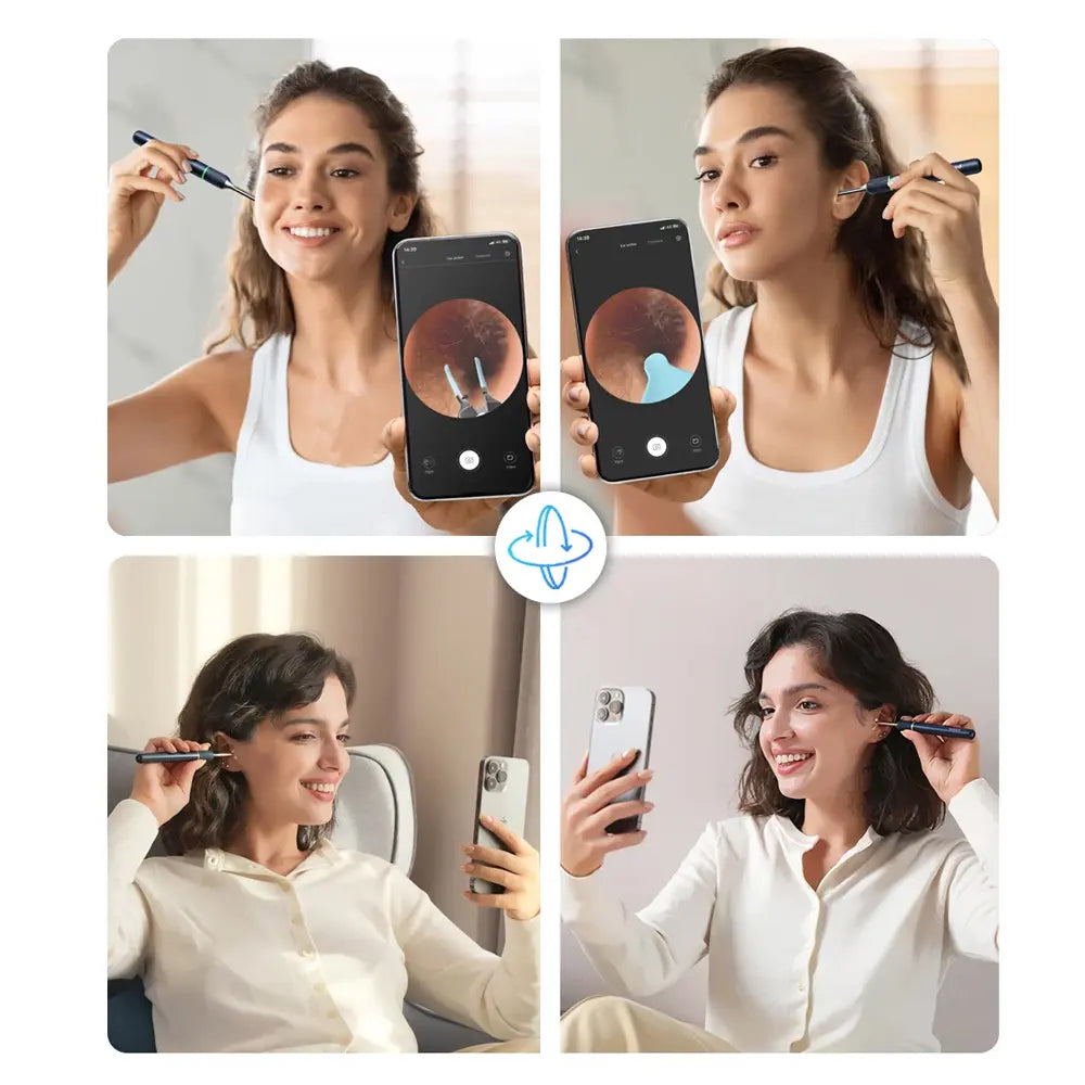 Bebird Note5 Pro Ear Wax Removal with Light 230mAh Battery 1080P Camera 360° Gyro Stabilizer Wireless