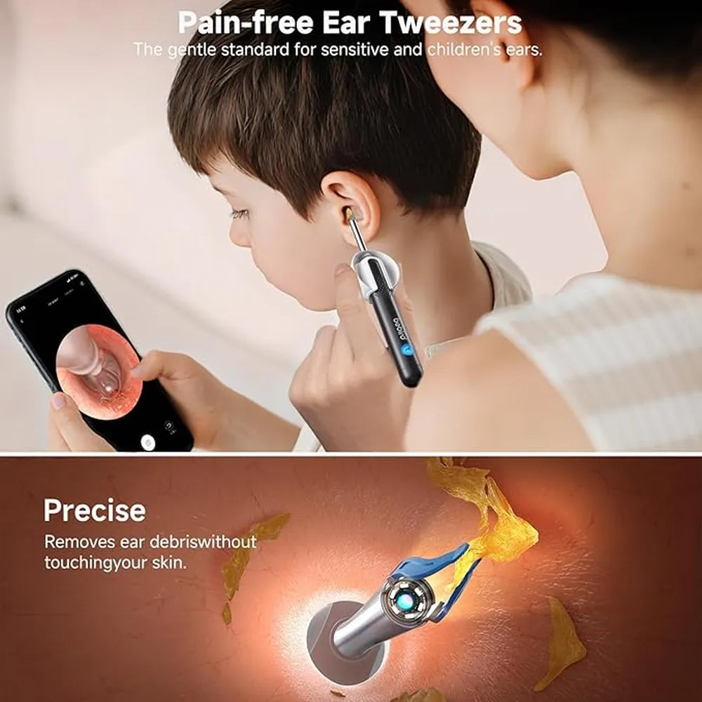 Bebird R1 Ultra Ear Camera With 6 LED Lights 1080P HD Camera USB Rechargeable