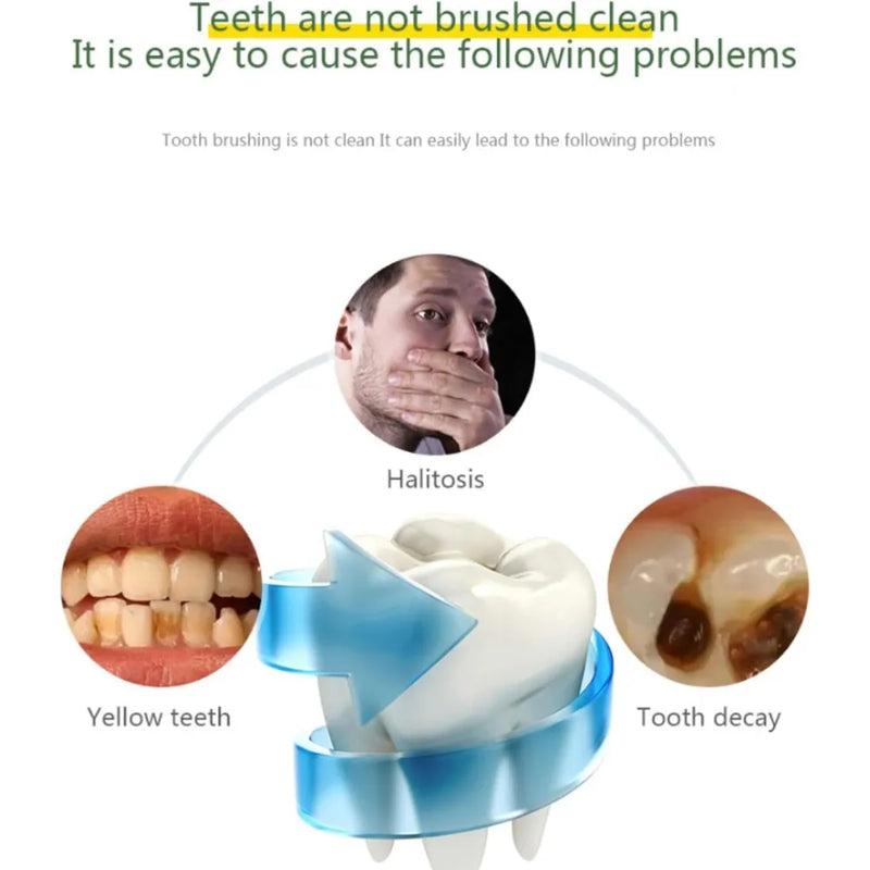 UltraClean Smart U-Shape Sonic Electric Toothbrush, 360° Automatic Silicone Hands-Free Toothbrush for Adults, IPX7 Waterproof (White)