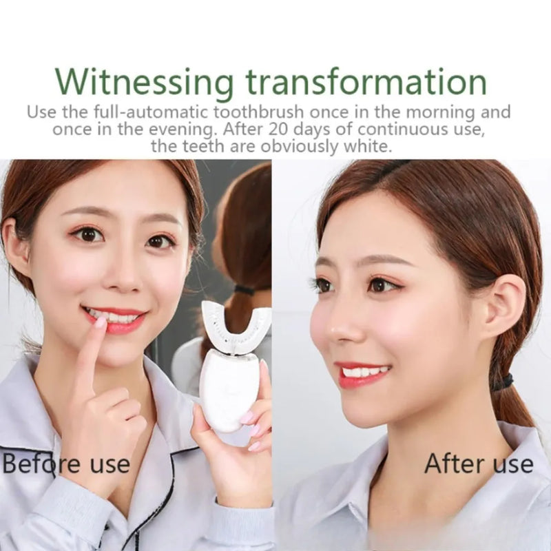 UltraClean Smart U-Shape Sonic Electric Toothbrush, 360° Automatic Silicone Hands-Free Toothbrush for Adults, IPX7 Waterproof (White)