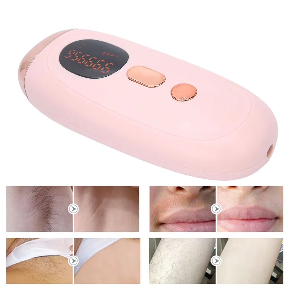 جهاز إزالة الشعر بالليزر بتقنية IPL، 999,999 ومضة، تقنية نقطة التجميد، 5 مستويات شدة - (أبيض)-3