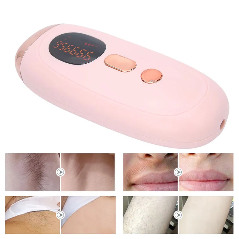 جهاز إزالة الشعر بالليزر بتقنية IPL، 999,999 ومضة، تقنية نقطة التجميد، 5 مستويات شدة - (أبيض)-3