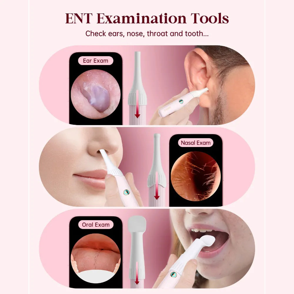 Bebird Earsight Plus Wireless Ear Wax Removal Camera - For Adults And Kids - Pink