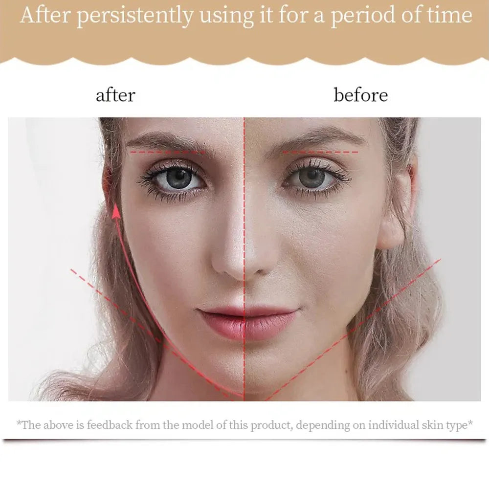 جهاز K-Skin KD907S لتعزيز تماسك البشرة وتحسين ملامح الوجه-5