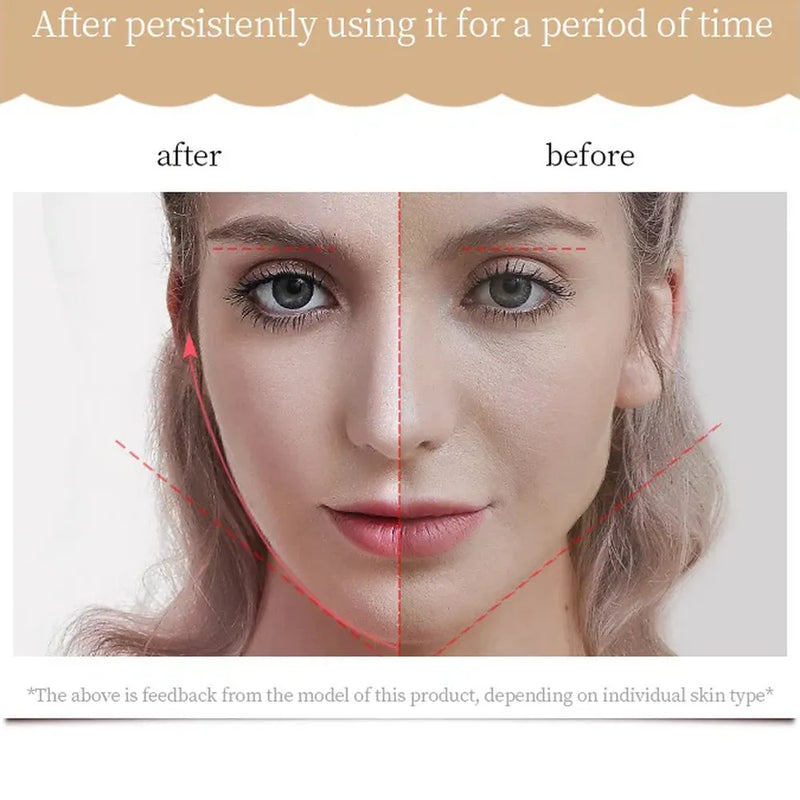 جهاز K-Skin KD907S لتعزيز تماسك البشرة وتحسين ملامح الوجه-5